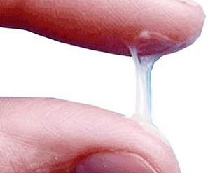 Hogyan néz ki normálisan egy férfi váladéka